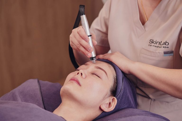 Aqua Peel Facial