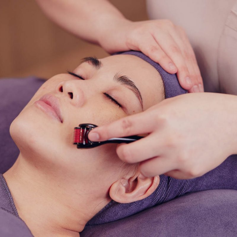 Derma Roller Facial
