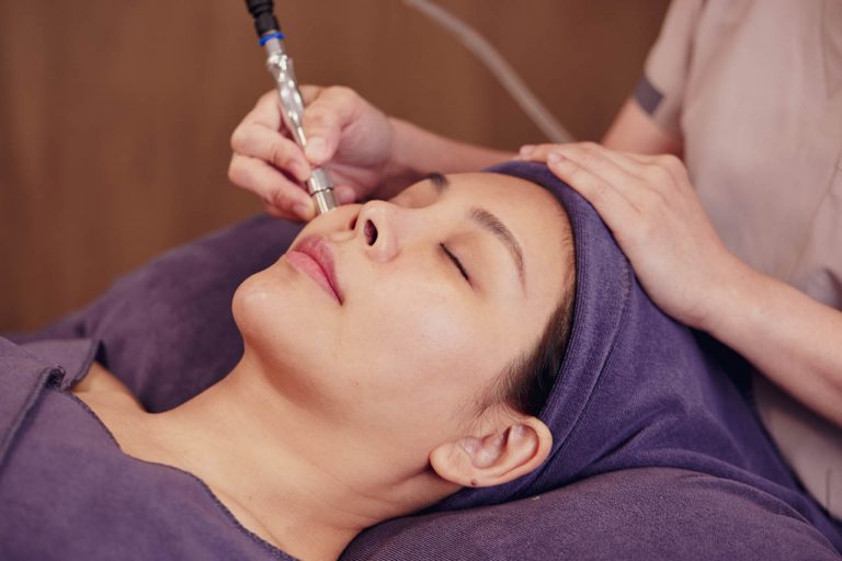 Diamond Peel & I2PL