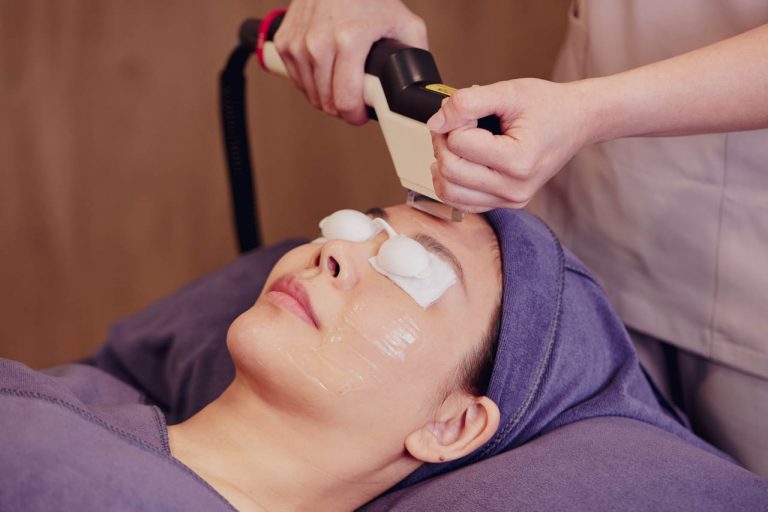 I2PL Photorejuvenation