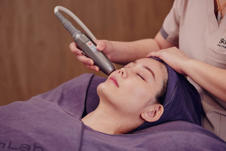 Liftera V-Face HIFU Treatment