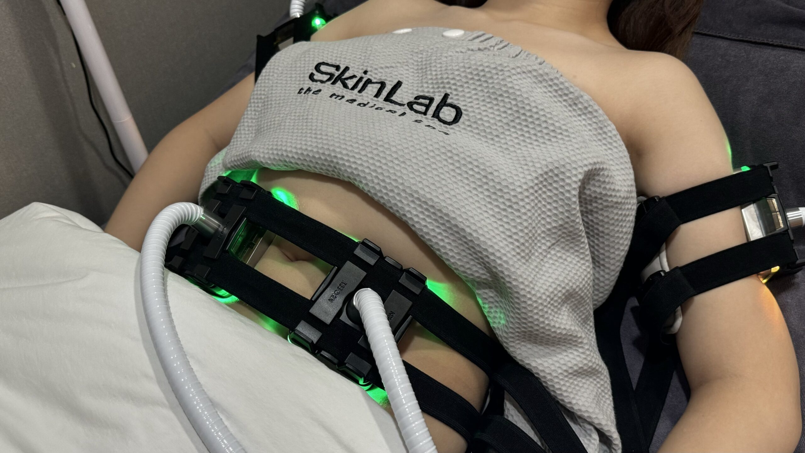 Common Types of Non-invasive Fat Reduction Treatments
