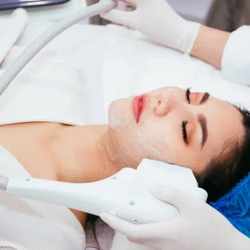 A woman receiving laser treatment at a medical spa